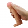 Extended Penis 1 Bunion